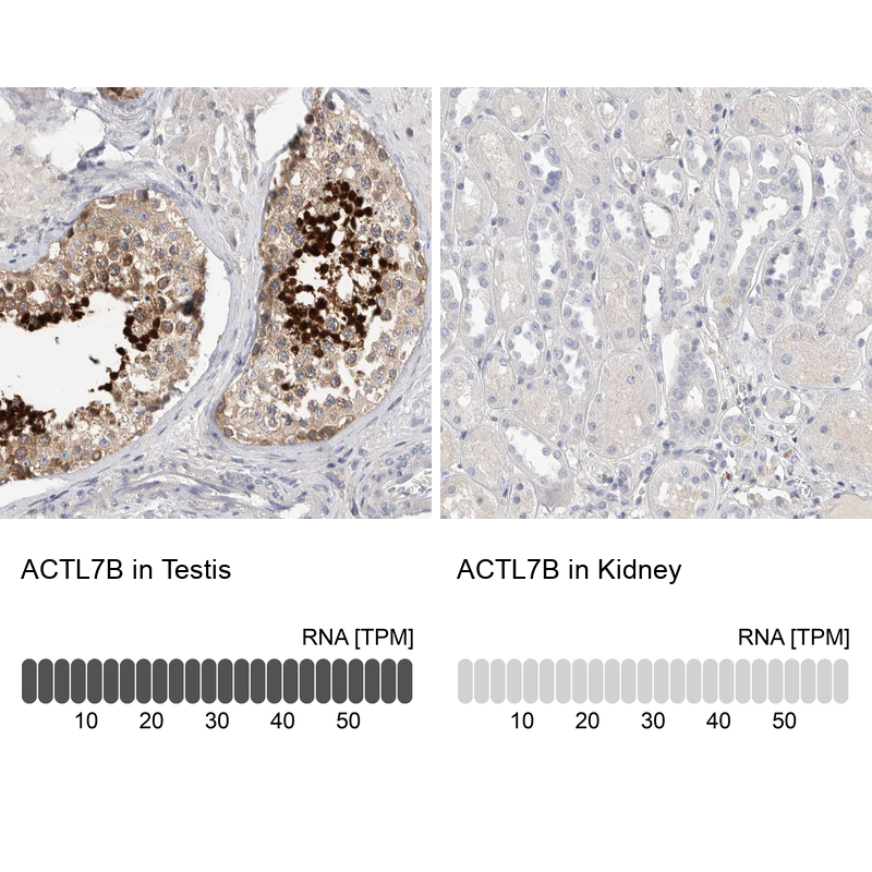 ACTL7B Antibody - BSA Free Immunohistochemistry-Paraffin: ACTL7B Antibody - BSA Free [NBP1-86972]