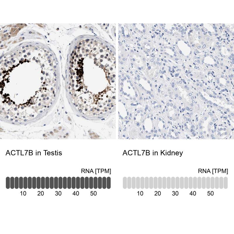 ACTL7B Antibody - BSA Free Immunohistochemistry-Paraffin: ACTL7B Antibody - BSA Free [NBP1-86973]