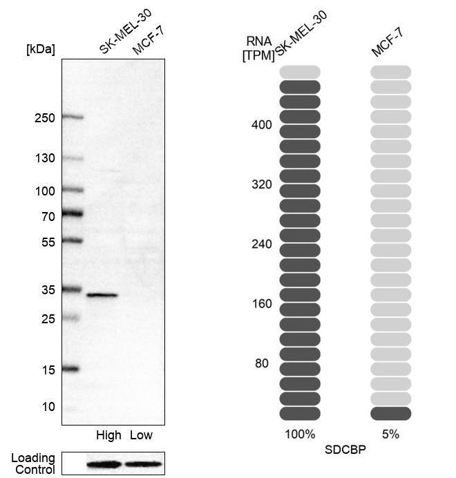 Syntenin 1 Antibody - BSA Free Western Blot: Syntenin 1 Antibody - BSA Free [NBP1-86979]