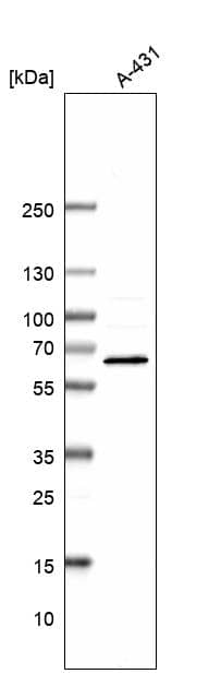 RIOK3 Antibody - BSA Free Western Blot: RIOK3 Antibody - BSA Free [NBP1-86982]