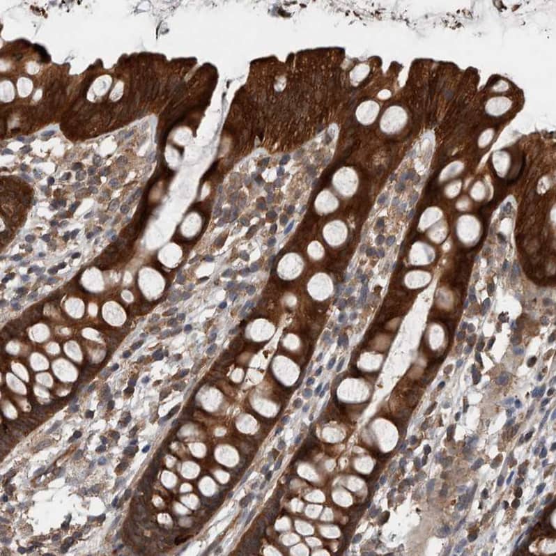 RIOK3 Antibody - BSA Free Immunohistochemistry-Paraffin: RIOK3 Antibody - BSA Free [NBP1-86982]
