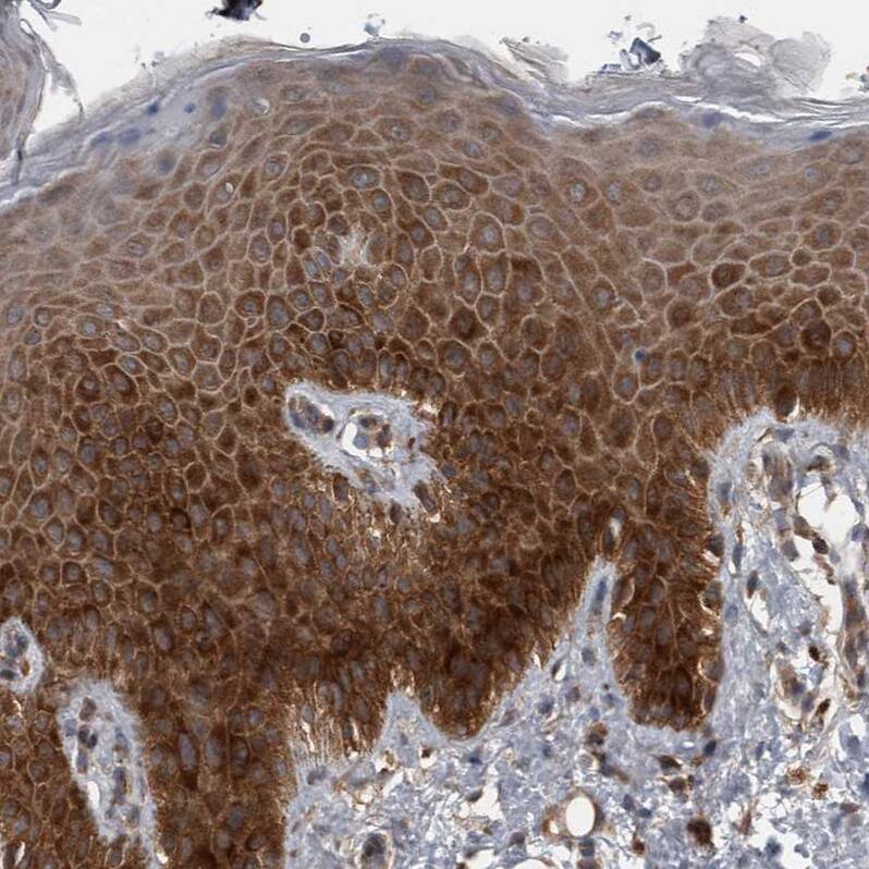 RIOK3 Antibody - BSA Free Immunohistochemistry-Paraffin: RIOK3 Antibody - BSA Free [NBP1-86982]