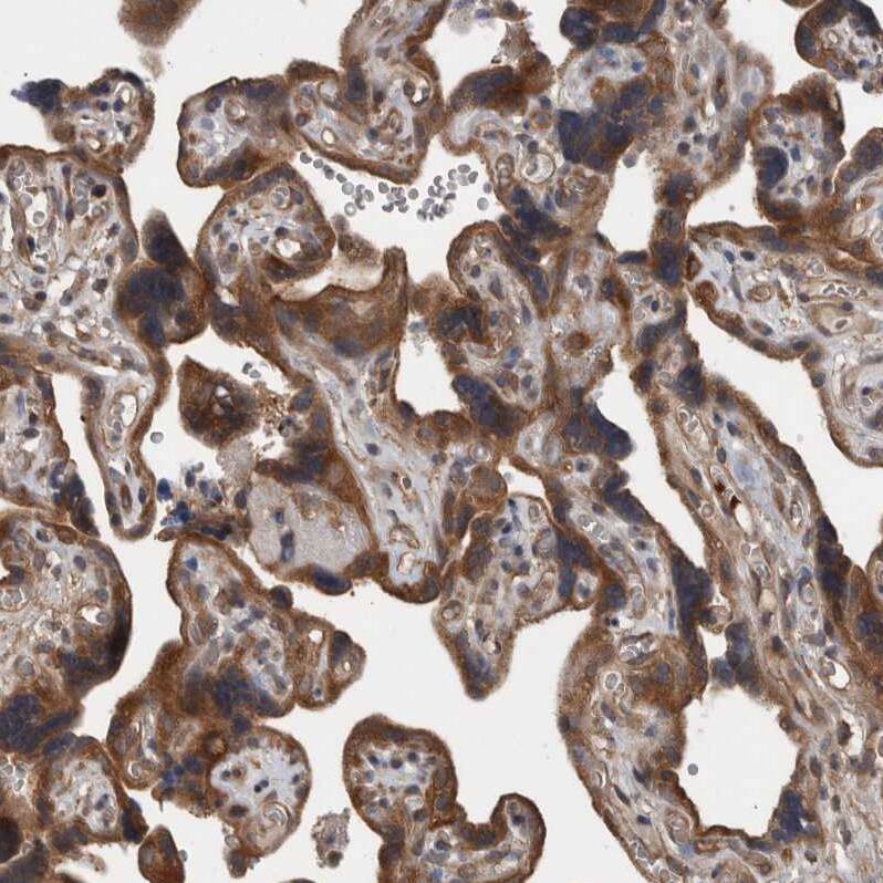 RIOK3 Antibody - BSA Free Immunohistochemistry-Paraffin: RIOK3 Antibody - BSA Free [NBP1-86982]