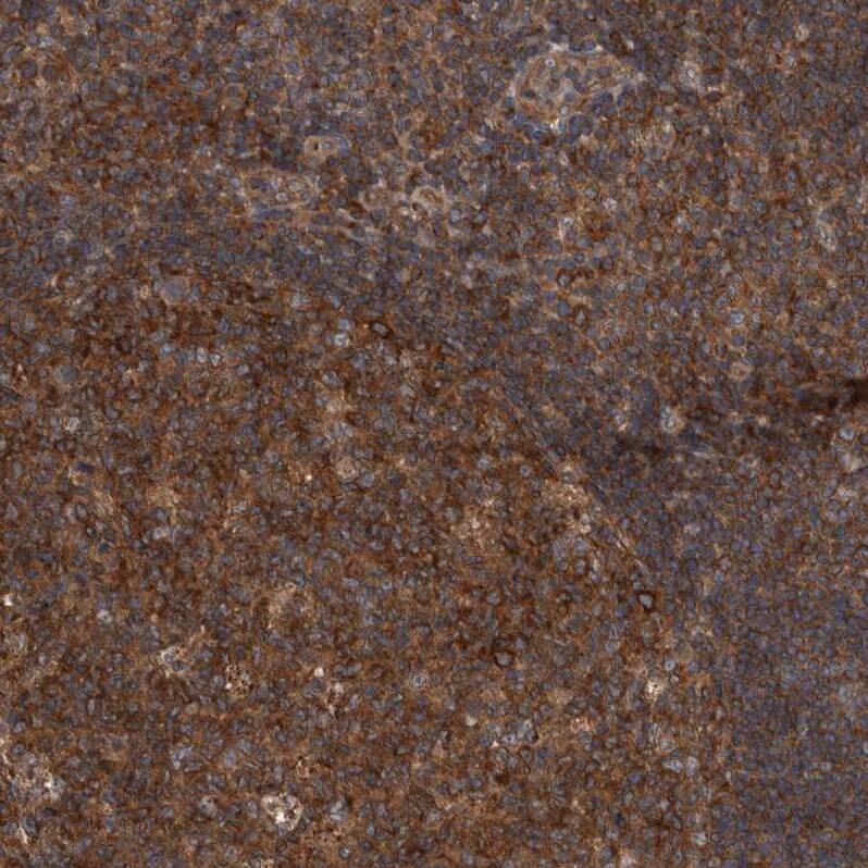 RIOK3 Antibody - BSA Free Immunohistochemistry-Paraffin: RIOK3 Antibody - BSA Free [NBP1-86982]