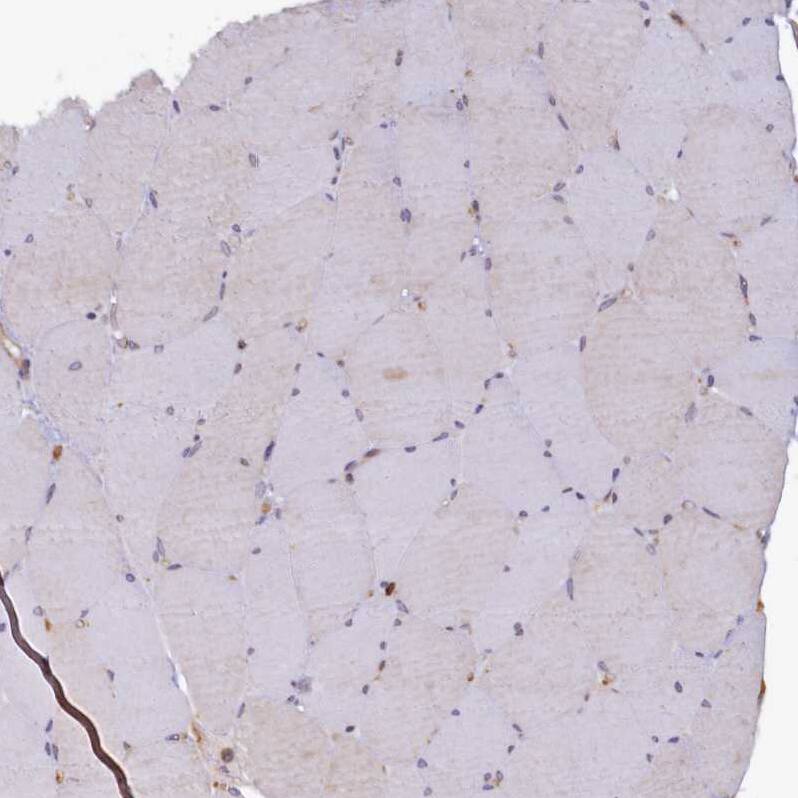 Syntaxin 12 Antibody - BSA Free Immunohistochemistry-Paraffin: Syntaxin 12 Antibody - BSA Free [NBP1-86985]