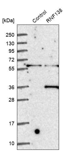 Ring finger protein 138 Antibody - BSA Free Western Blot: Ring finger protein 138 Antibody - BSA Free [NBP1-86987]