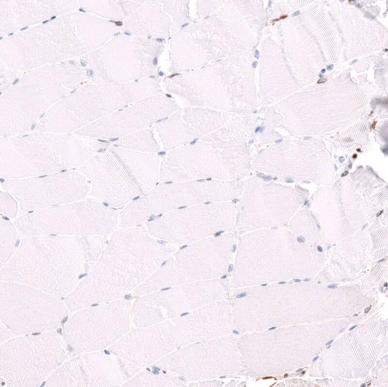 Glycine Receptor Alpha 1 Antibody - BSA Free Immunohistochemistry-Paraffin: Glycine Receptor Alpha 1 Antibody - BSA Free [NBP1-86988]