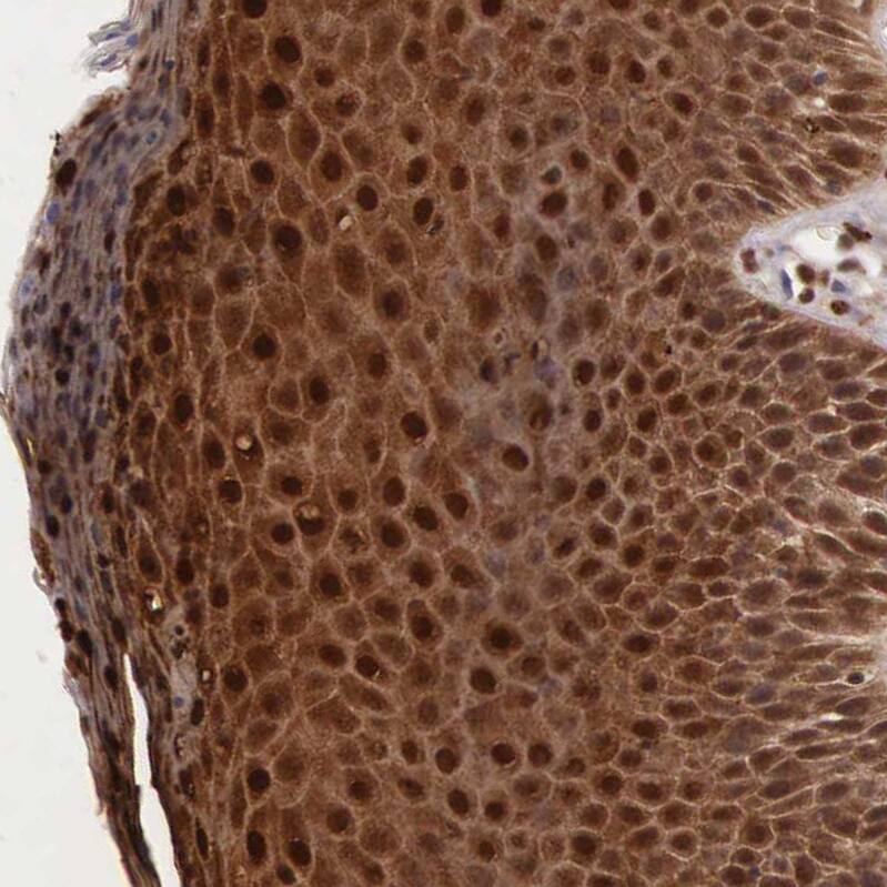 Cystatin A Antibody - BSA Free Immunohistochemistry-Paraffin: Cystatin A Antibody - BSA Free [NBP1-86989]