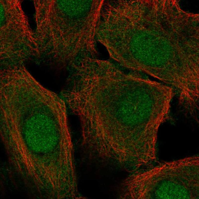 Cystatin A Antibody - BSA Free Immunohistochemistry-Paraffin: Cystatin A Antibody - BSA Free [NBP1-86989]