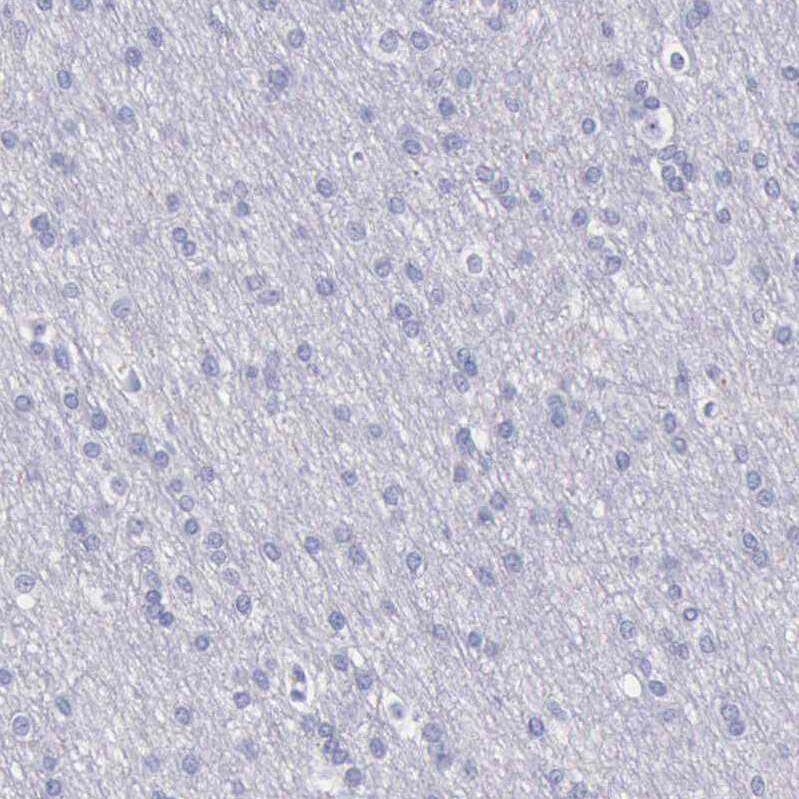 Cystatin A Antibody - BSA Free Immunohistochemistry-Paraffin: Cystatin A Antibody - BSA Free [NBP1-86989]