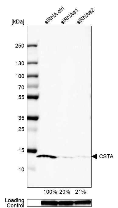 Cystatin A Antibody - BSA Free Western Blot: Cystatin A Antibody - BSA Free [NBP1-86989]
