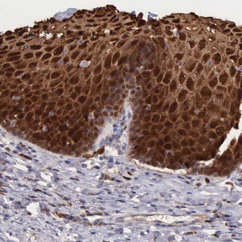 Cystatin A Antibody - BSA Free Immunohistochemistry-Paraffin: Cystatin A Antibody - BSA Free [NBP1-86989]