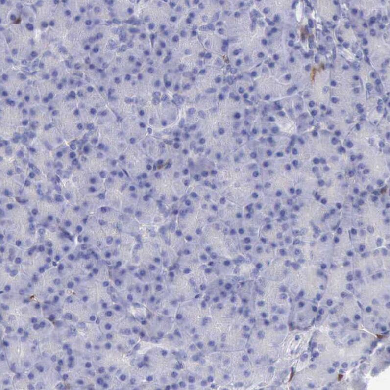 Cystatin A Antibody - BSA Free Immunohistochemistry-Paraffin: Cystatin A Antibody - BSA Free [NBP1-86989]