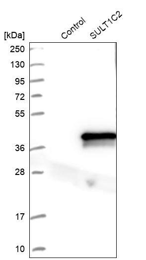 Cytosolic Sulfotransferase 1C2/SULT1C2 Antibody - BSA Free Western Blot: Cytosolic Sulfotransferase 1C2/SULT1C2 Antibody - BSA Free [NBP1-86994]