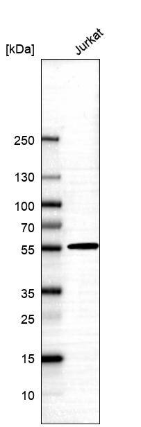 ALDH5A1 Antibody - BSA Free Western Blot: ALDH5A1 Antibody - BSA Free [NBP1-86996]