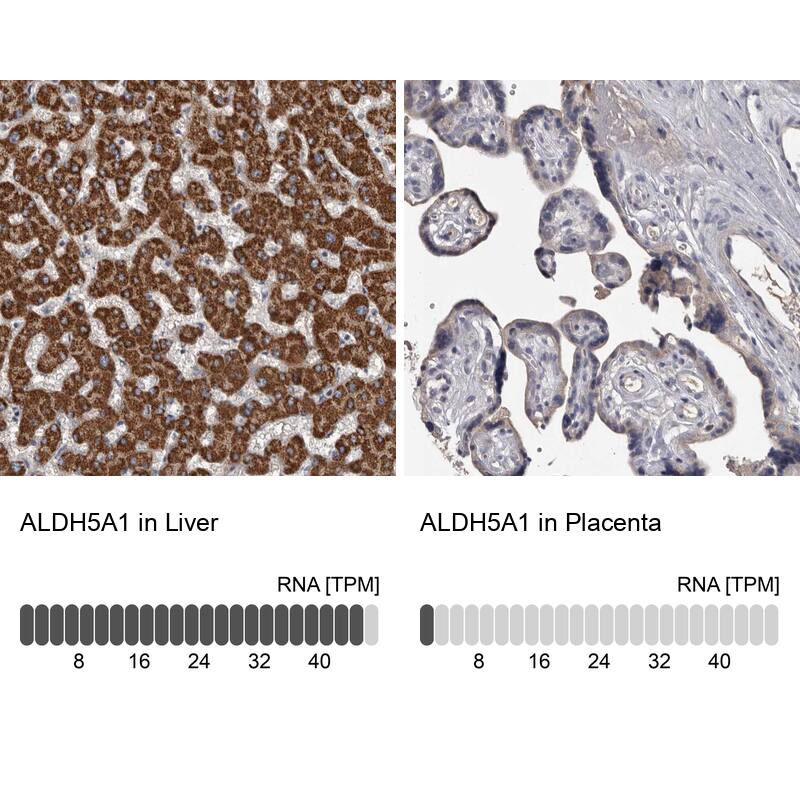 ALDH5A1 Antibody - BSA Free Immunohistochemistry-Paraffin: ALDH5A1 Antibody - BSA Free [NBP1-86996]
