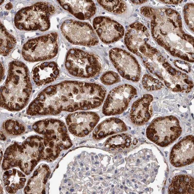 ALDH5A1 Antibody - BSA Free Immunohistochemistry-Paraffin: ALDH5A1 Antibody - BSA Free [NBP1-86996]