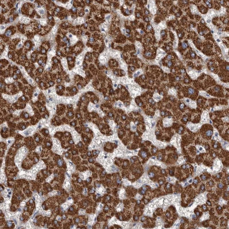 ALDH5A1 Antibody - BSA Free Immunohistochemistry-Paraffin: ALDH5A1 Antibody - BSA Free [NBP1-86996]