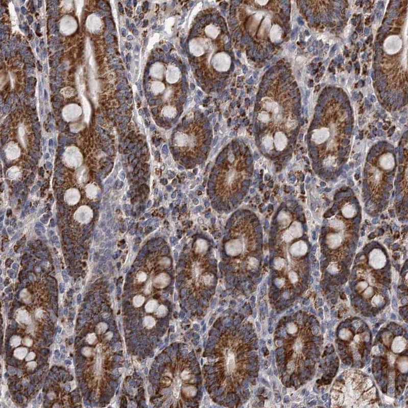 ALDH5A1 Antibody - BSA Free Immunohistochemistry-Paraffin: ALDH5A1 Antibody - BSA Free [NBP1-86996]