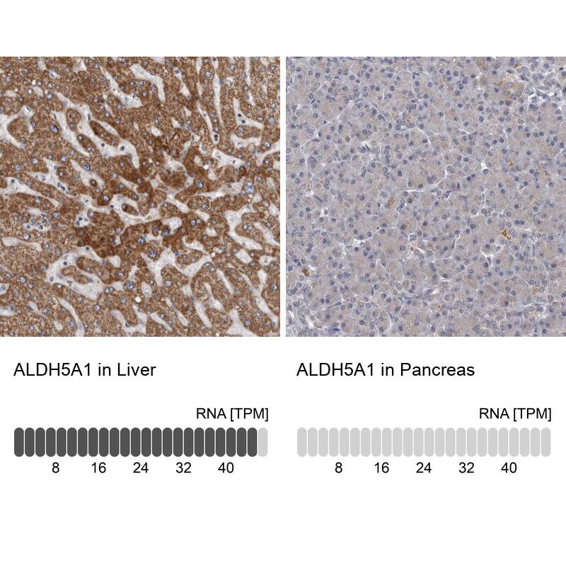 ALDH5A1 Antibody - BSA Free Immunohistochemistry-Paraffin: ALDH5A1 Antibody [NBP1-86997]