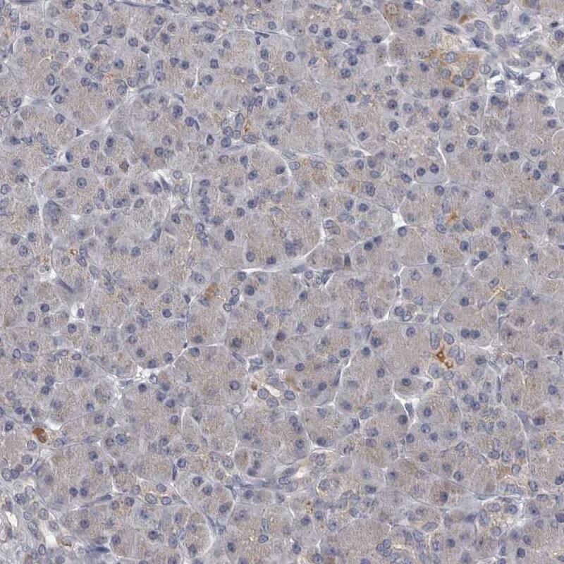 ALDH5A1 Antibody - BSA Free Immunohistochemistry-Paraffin: ALDH5A1 Antibody [NBP1-86997]