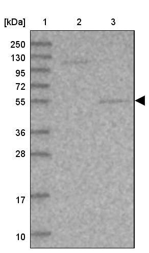 SRPX2 Antibody - BSA Free Western Blot: SRPX2 Antibody - BSA Free [NBP1-86999]