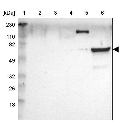 ZAP70 Antibody - BSA Free Western Blot: ZAP70 Antibody - BSA Free [NBP1-87000]