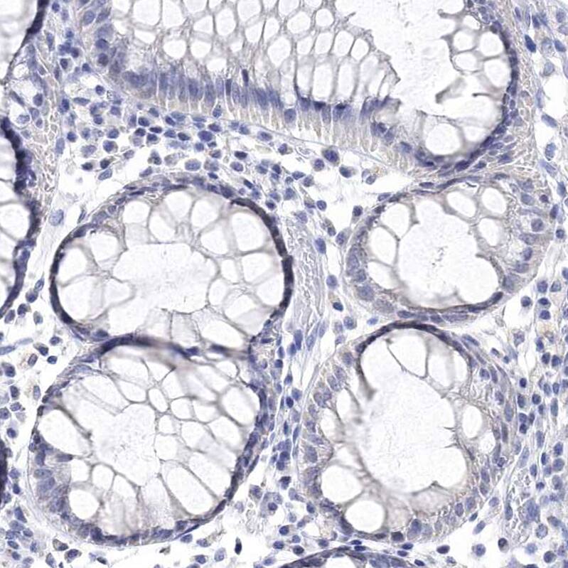 Synaptotagmin 12 Antibody - BSA Free Immunohistochemistry-Paraffin: Synaptotagmin 12 Antibody - BSA Free [NBP1-87001]