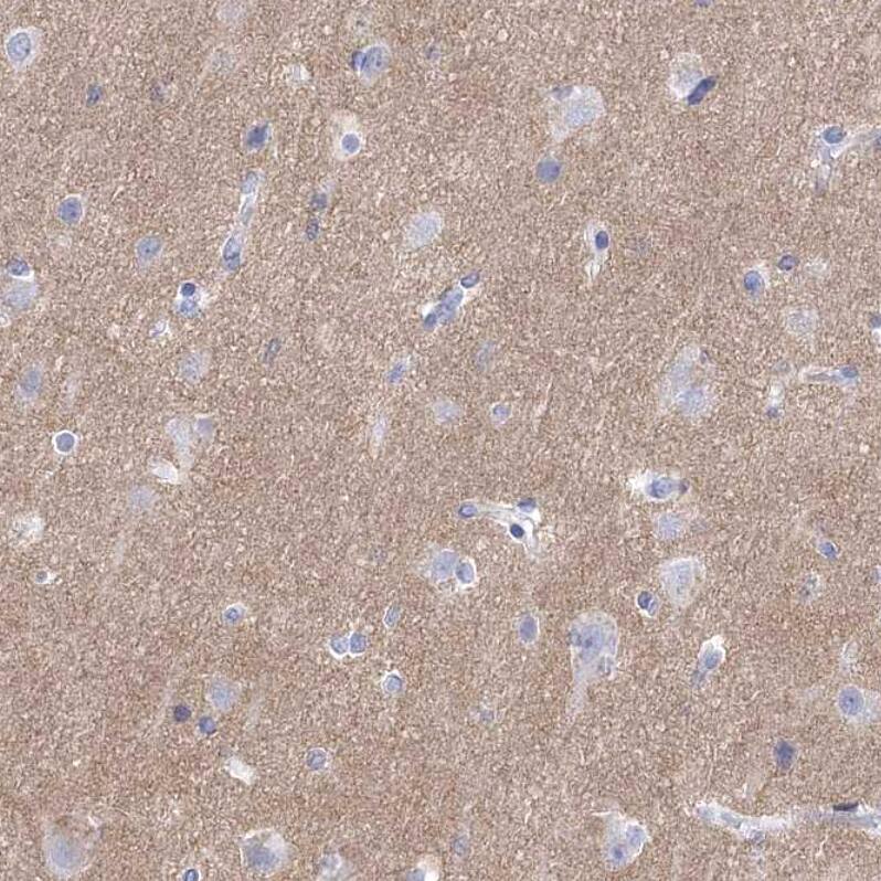 Synaptotagmin 12 Antibody - BSA Free Immunohistochemistry-Paraffin: Synaptotagmin 12 Antibody - BSA Free [NBP1-87001]