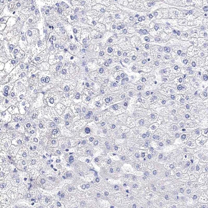 Synaptotagmin 12 Antibody - BSA Free Immunohistochemistry-Paraffin: Synaptotagmin 12 Antibody - BSA Free [NBP1-87001]