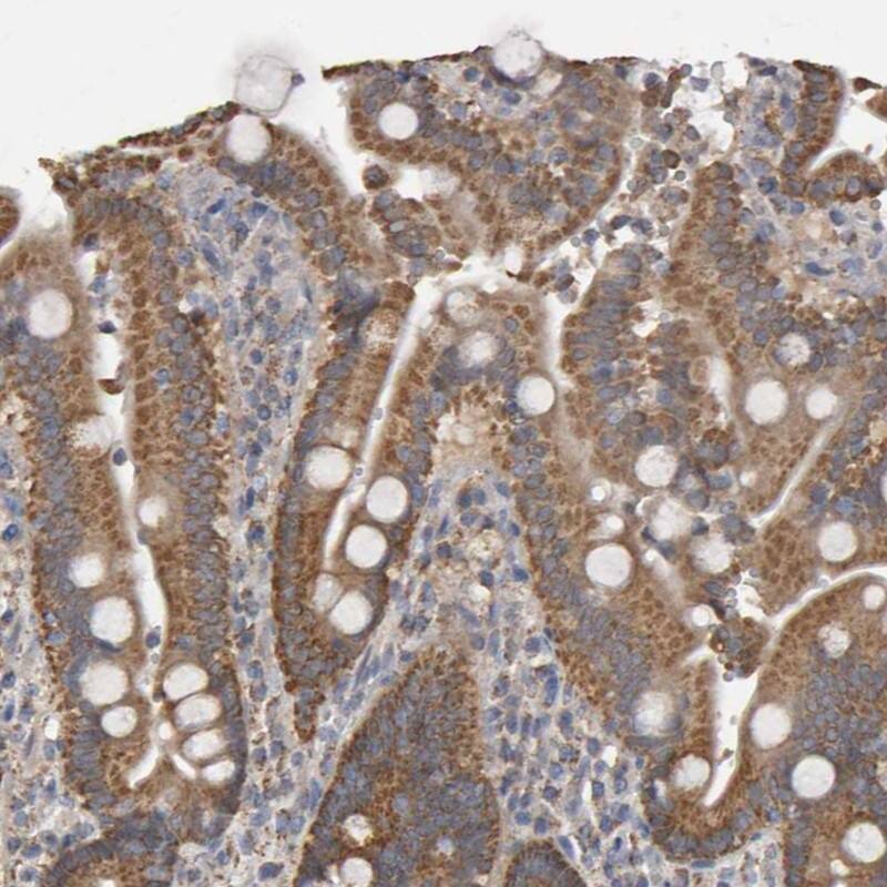 TOM1L1 Antibody - BSA Free Immunohistochemistry-Paraffin: TOM1L1 Antibody - BSA Free [NBP1-87004]