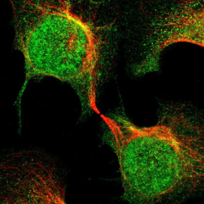 MED21 Antibody - BSA Free Immunocytochemistry/ Immunofluorescence: MED21 Antibody [NBP1-87006]