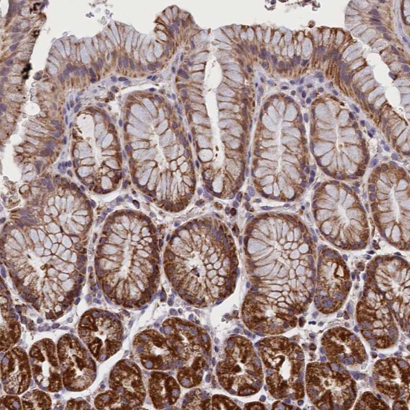 IFT122 Antibody - BSA Free Immunohistochemistry-Paraffin: IFT122 Antibody - BSA Free [NBP1-87014]