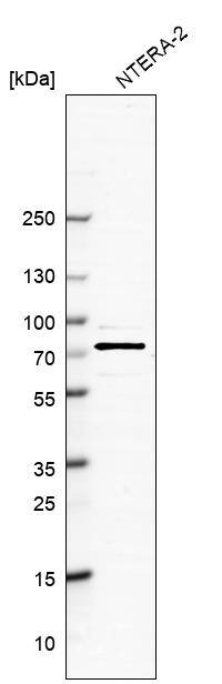 SnoN Antibody - BSA Free Western Blot: SnoN Antibody - BSA Free [NBP1-87020]