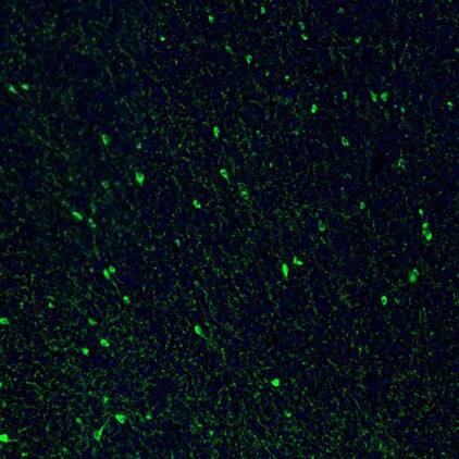 Somatostatin Antibody - BSA Free Immunohistochemistry-Paraffin: Somatostatin Antibody [NBP1-87022]