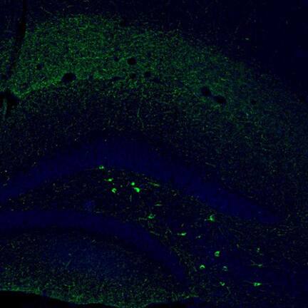 Somatostatin Antibody - BSA Free Immunohistochemistry-Paraffin: Somatostatin Antibody [NBP1-87022]