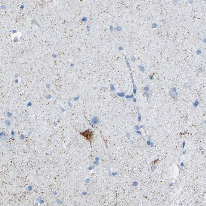 Somatostatin Antibody - BSA Free Immunohistochemistry-Paraffin: Somatostatin Antibody [NBP1-87022]