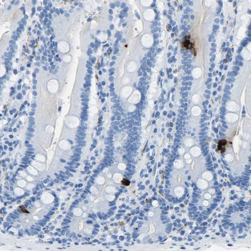 Somatostatin Antibody - BSA Free Immunohistochemistry-Paraffin: Somatostatin Antibody [NBP1-87022]