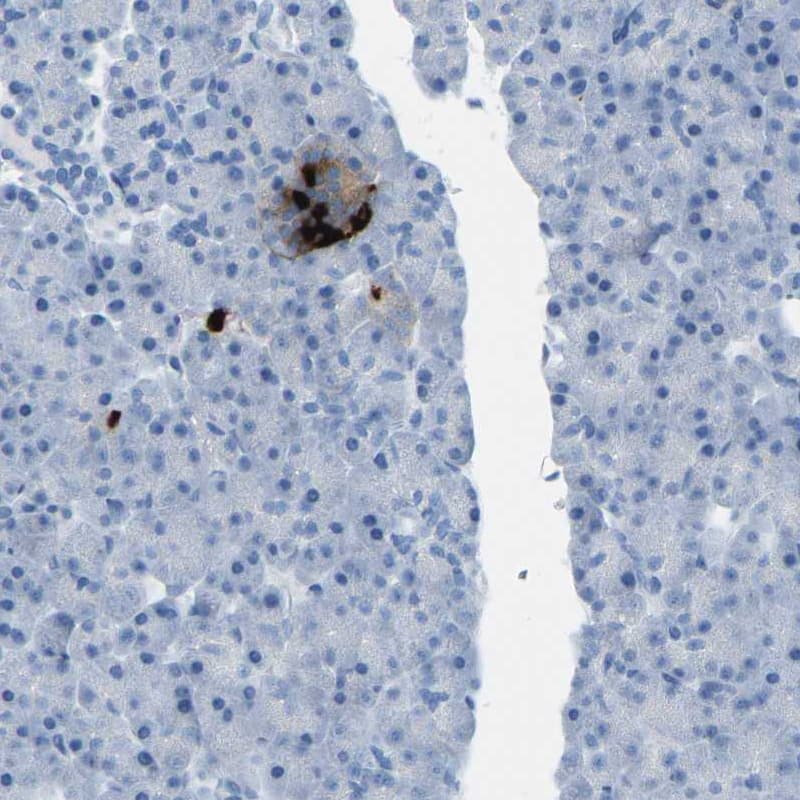 Somatostatin Antibody - BSA Free Immunohistochemistry-Paraffin: Somatostatin Antibody [NBP1-87022]