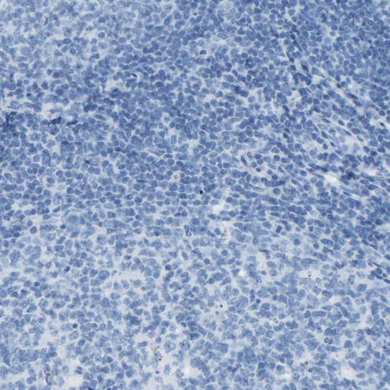 Somatostatin Antibody - BSA Free Immunohistochemistry-Paraffin: Somatostatin Antibody [NBP1-87022]