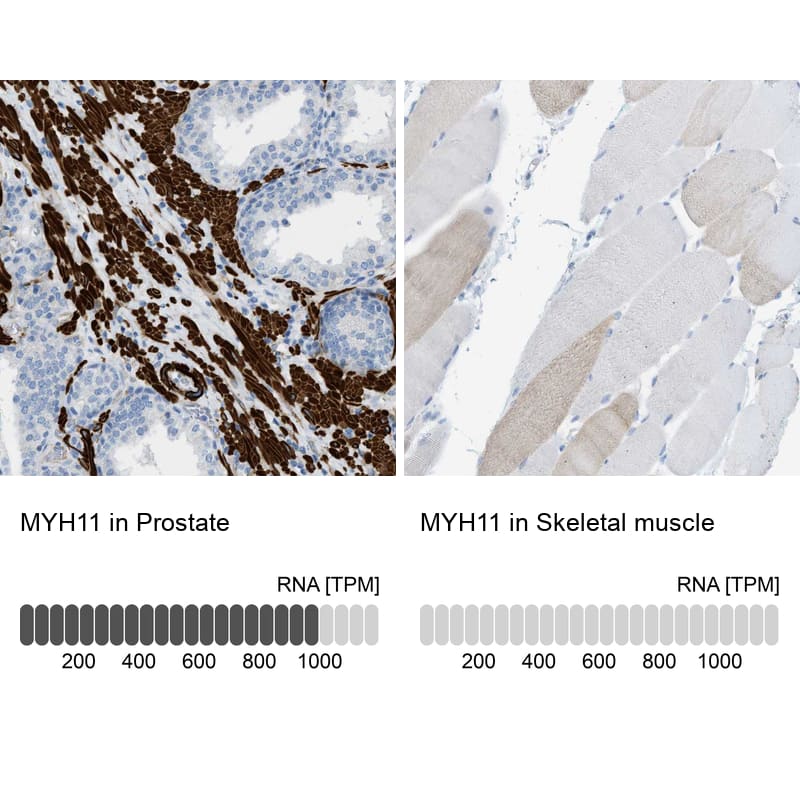 Myosin heavy chain 11 Antibody - BSA Free Immunohistochemistry-Paraffin: Myosin heavy chain 11 Antibody - BSA Free [NBP1-87025]