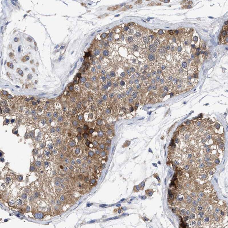 RAP1GDS1 Antibody - BSA Free Immunohistochemistry-Paraffin: RAP1GDS1 Antibody - BSA Free [NBP1-87027]