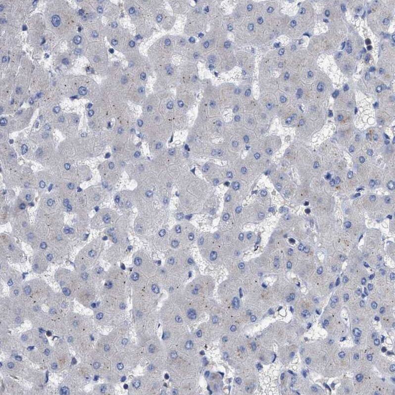 RAP1GDS1 Antibody - BSA Free Immunohistochemistry-Paraffin: RAP1GDS1 Antibody - BSA Free [NBP1-87027]