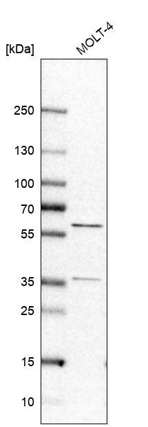 RAP1GDS1 Antibody - BSA Free Western Blot: RAP1GDS1 Antibody - BSA Free [NBP1-87027]