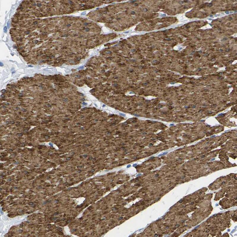 Calponin 1 Antibody - BSA Free Immunohistochemistry-Paraffin: Calponin 1 Antibody - BSA Free [NBP1-87029]
