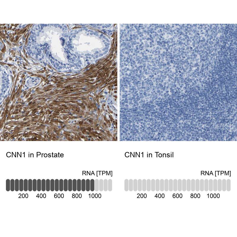Calponin 1 Antibody - BSA Free Immunohistochemistry-Paraffin: Calponin 1 Antibody - BSA Free [NBP1-87029]