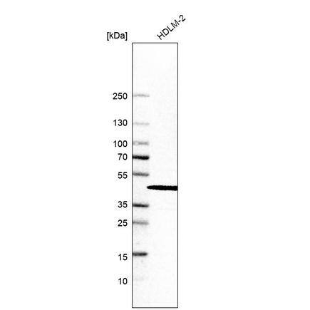 SKIP Antibody - BSA Free Western Blot: SKIP Antibody - BSA Free [NBP1-87034]