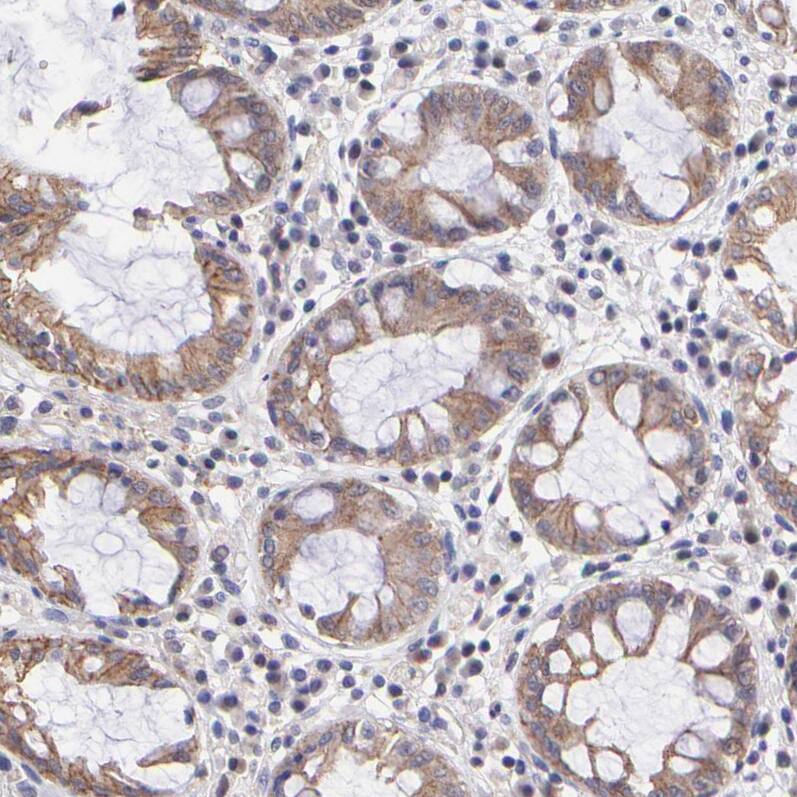 NSF Antibody - BSA Free Immunohistochemistry-Paraffin: NSF Antibody - BSA Free [NBP1-87035]