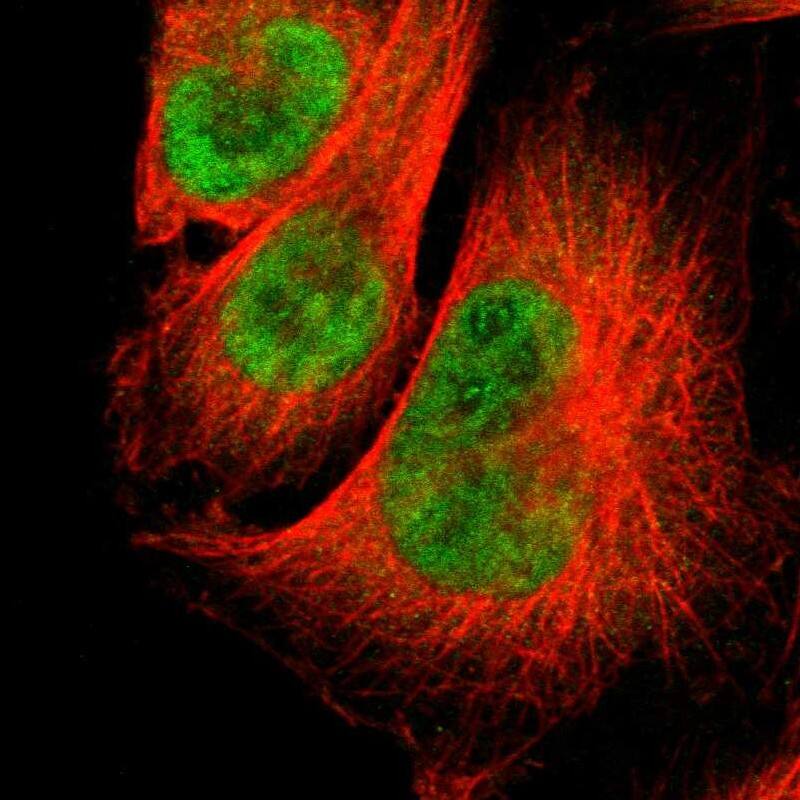 Sirtuin 1/SIRT1 Antibody - BSA Free Immunohistochemistry-Paraffin: Sirtuin 1/SIRT1 Antibody - BSA Free [NBP1-87038]