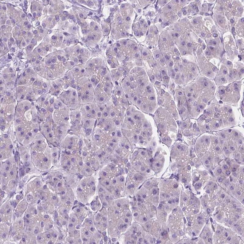 Sirtuin 2/SIRT2 Antibody - BSA Free Immunohistochemistry-Paraffin: Sirtuin 2/SIRT2 Antibody - BSA Free [NBP1-87039]